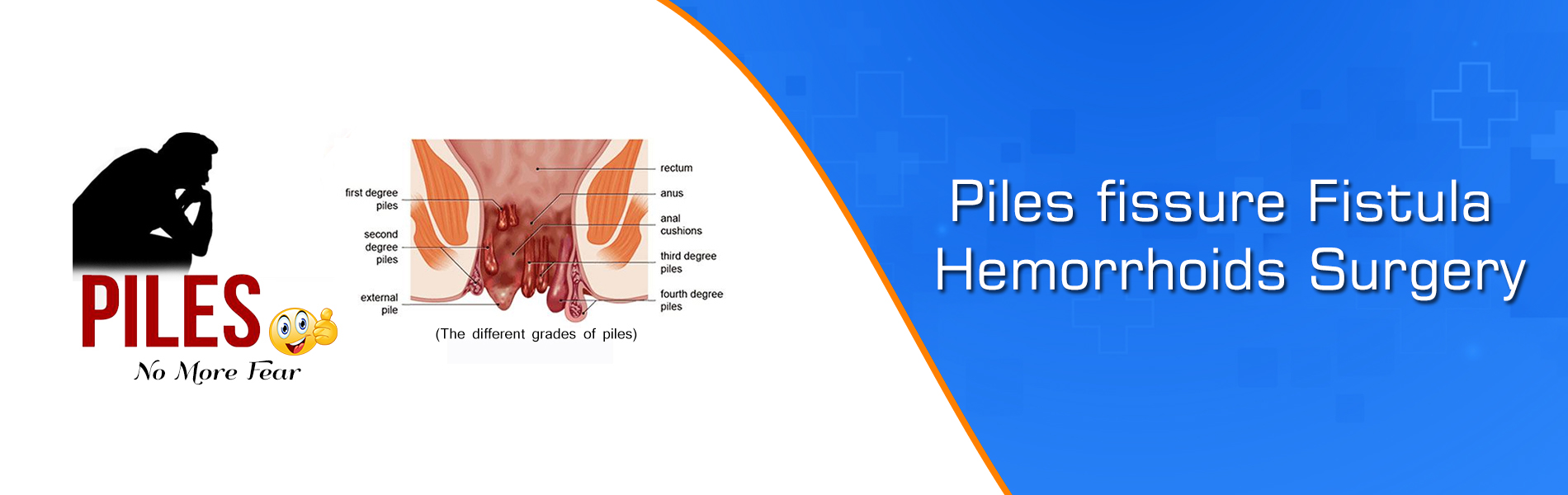 Best Pile Fissure Fistula Hemorrhoids Surgery Center In Kuchaman City